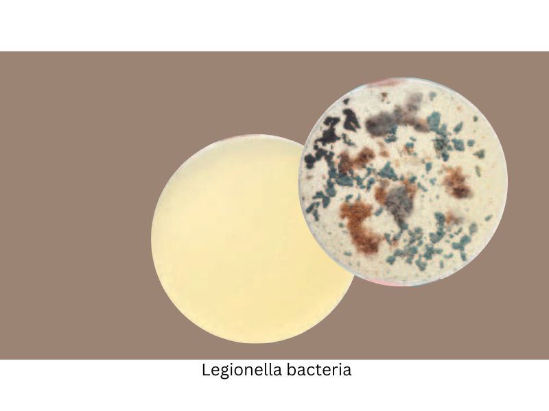 Legionella bacteria